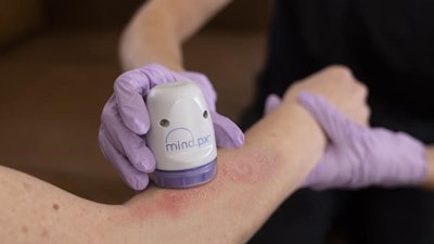Minderahealth Mindpx
