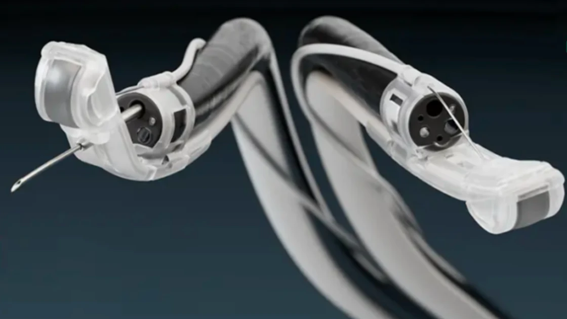 Eus Device FDA Approves Ultrasound Device that Attaches to Endoscopes | Medical ...