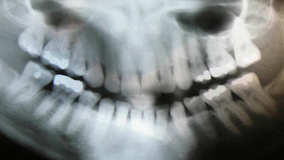 Ap24032673114693