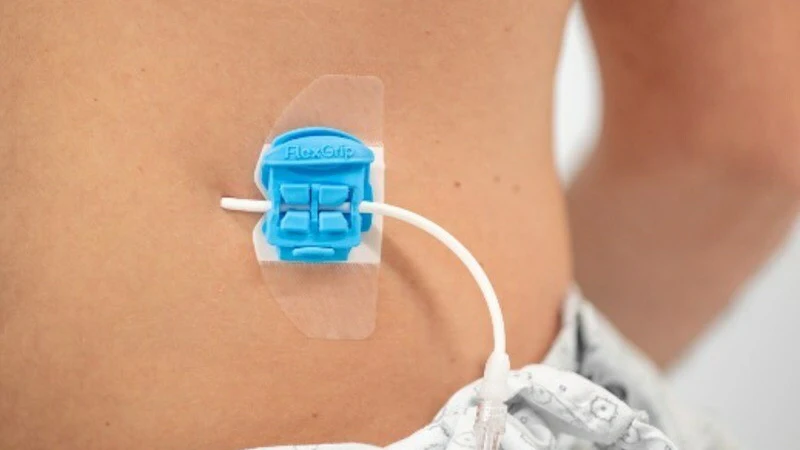 Cook Connector Device Cook Medical Debuts New Catheter Securement Devices | Medical Design ...