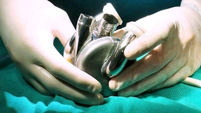 Bi Vacor Total Artificial Heart Surgery