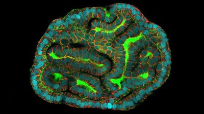 This microscope image provided by researchers in March 2024 shows a kidney organoid resembling renal tubules, created from cells collected from amniotic fluid.
