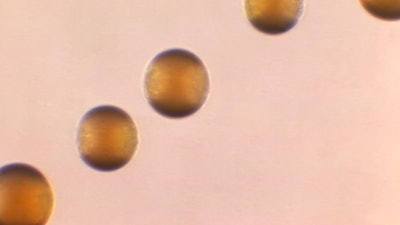 This 1966 microscope photo shows five colonies of Group-B Neisseria meningitidis bacteria.
