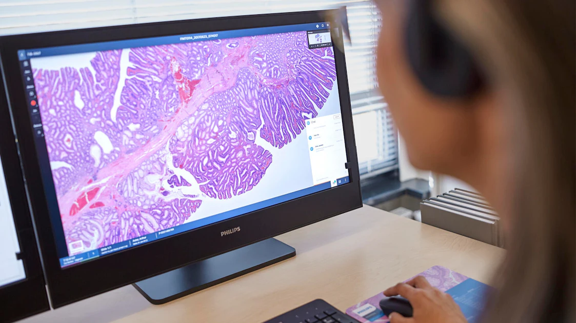 Philips and AWS Collaborate to Scale Digital Pathology in the Cloud ...