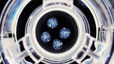 Image of microscopic cystic kidney organoids derived from patient induced pluripotent stem cells.