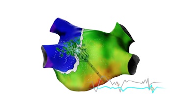 Biosense Carto Elevate With Signals 5 6 2024 V2