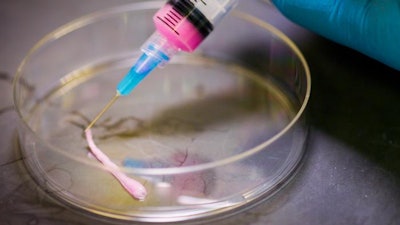 Fred Hutch scientists led by Matthias Stephan, MD, PhD, demonstrate how a foam administered in a syringe could be used to deliver gene therapy products.