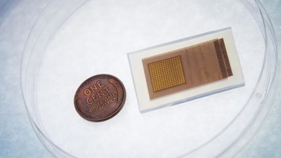This soft and stretchy ultrasound patch can be worn on the temple to provide continuous monitoring of blood flow in the brain. During use, the patch is connected through cables to a power source and computer.