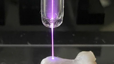 The Achilles tendon of a rat is irradiated with non-thermal atmospheric-pressure plasma.