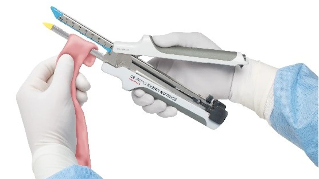 J&J Subsidiary Ethicon Launches Surgical Stapler Designed to Reduce ...