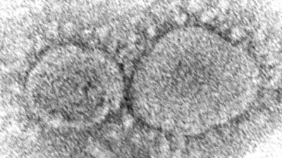 Ap24164641377405