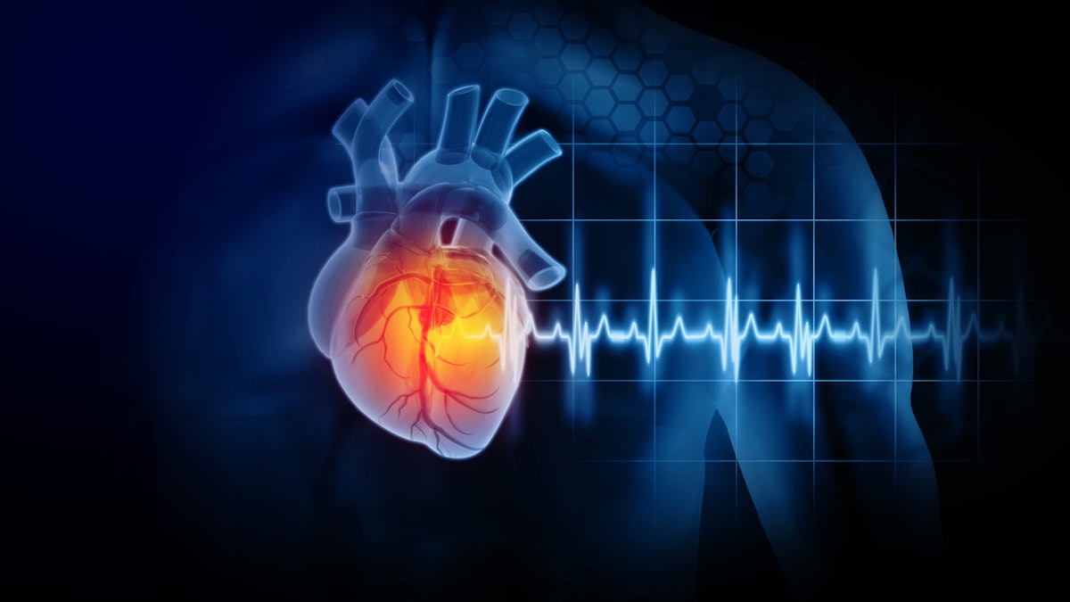 Abbott Gets CE Mark for Dual Chamber Leadless Pacemaker System ...
