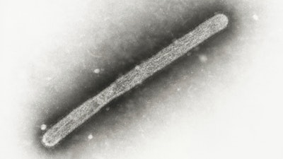 This 2005 electron microscope image shows an avian influenza A H5N1 virion. The Centers for Disease Control and Prevention on Tuesday, July 30, 2024, announced it will spend $5 million to buy seasonal flu shots for livestock workers.