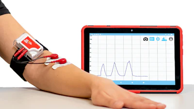 JOGO Health's proprietary non-invasive digital therapeutic device built with AI and wearables, JOGO-Gx, has shown early success as a Parkinson's Disease treatment.