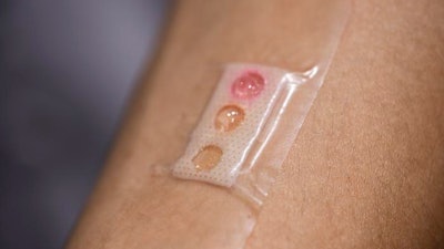 The plaster developed by NTU Singapore researchers comprises microlaser sensors embedded in liquid crystal droplets. The sensors are customized to pick up three different types of biomarkers (lactate, glucose, urea). A different colored liquid crystal dot on the plaster distinguishes each biomarker.