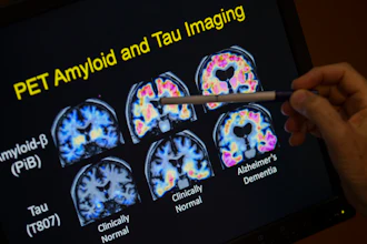 A doctor points to PET scan results that are part of a study on Alzheimer's disease at Georgetown University Hospital, on Tuesday, May 19, 2015, in Washington.