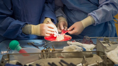 Surgeons work on a kidney during a transplant surgical procedure in Washington on June 28, 2016.