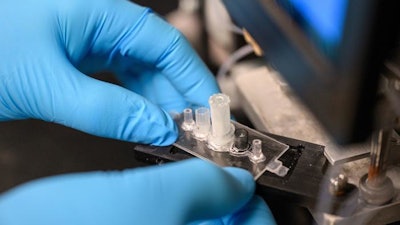 The biochip is used to detect biomarkers for glioblastoma, a fast-growing brain cancer.