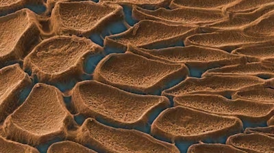 An electron-microscopy image of the teeth inside a squid sucker.