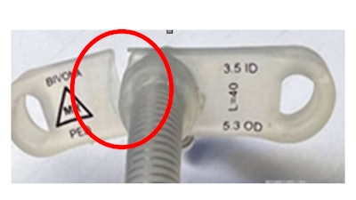 The securement flange of specific lots of the Bivona® Neonatal/Pediatric and Adult Tracheostomy products may tear because of a manufacturing defect.