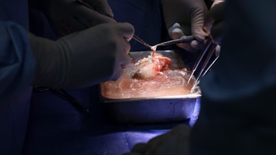 20240316 Mcr Kidney Transplant 268 1