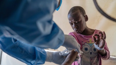 A health worker attends to a mpox patient, at a treatment centre in Munigi, eastern Congo, Aug. 19, 2024.