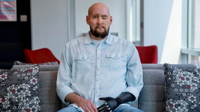 Over a year after a whole-eye and partial-face transplant, Aaron James has made a remarkable recovery, back to daily life in Arkansas.