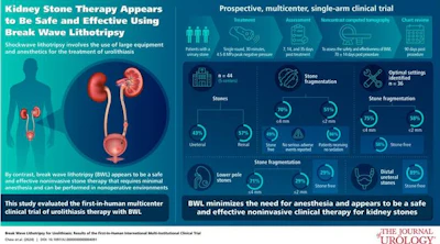 Visual abstract of article “Break Wave Lithotripsy for Urolithiasis: Results of the First-in-Human International Multi-Institutional Clinical Trial.”