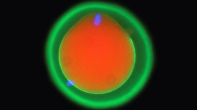 This microscope image provided by Osaka University and the Research Institute of Molecular Pathology in October 2024, shows the fertilization of a mouse egg marked in red and green. DNA is marked in blue, showing in the egg at the top and in a sperm cell at the bottom left.