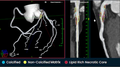 Fda Image 1