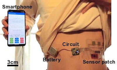 The sensor patch is connected to a processor (circuit) that includes a Bluetooth module and is powered by a battery. The Bluetooth module allows the sensor patch to be linked to a phone to record data.