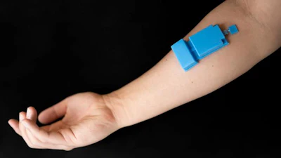 Low Res Ultrasound Muscle Monitor 1
