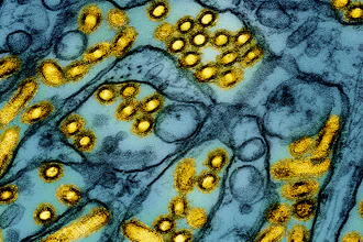 This colorized electron microscope image released by the National Institute of Allergy and Infectious Diseases on March 26, 2024, shows avian influenza A H5N1 virus particles (yellow), grown in Madin-Darby Canine Kidney (MDCK) epithelial cells (blue).