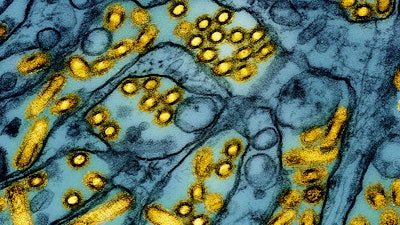 This colorized electron microscope image released by the National Institute of Allergy and Infectious Diseases on March 26, 2024, shows avian influenza A H5N1 virus particles (yellow), grown in Madin-Darby Canine Kidney (MDCK) epithelial cells (blue).