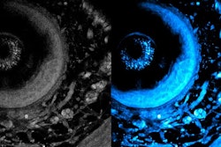 The new technique enables laser light to penetrate deeper into living tissue, which captures sharper images of cells at different layers of a living system. On left is the initial image, and on right is the optimized image using the new technique.