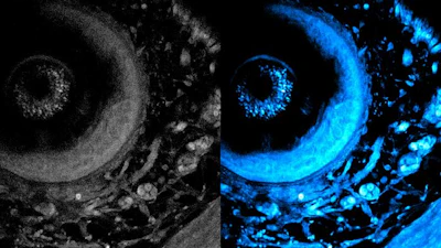 The new technique enables laser light to penetrate deeper into living tissue, which captures sharper images of cells at different layers of a living system. On left is the initial image, and on right is the optimized image using the new technique.