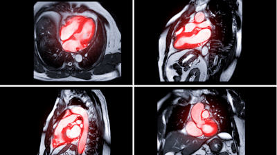 Collection of MRI heart or Cardiac MRI magnetic resonance imaging of heart for diagnosis heart disease.