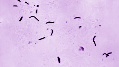 This 1966 microscope photo provided by the U.S. Centers for Disease Control and Prevention shows Mycobacterium tuberculosis bacilli, the organism responsible for causing the disease tuberculosis.