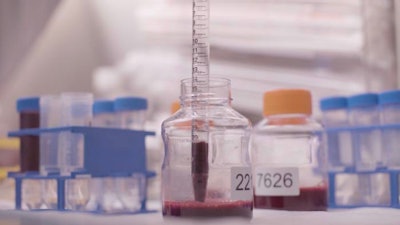 Low Res Blood Sample – Allen Institute For Immunology