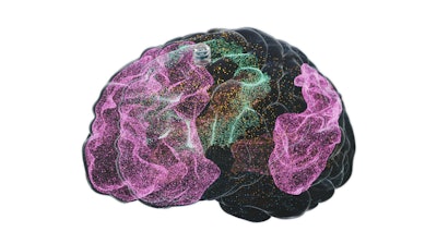 Motif Neurotech Dot Neural Device