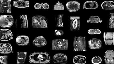 Example MRI scans in the training dataset. Since images were randomly sampled from clinical routine, the dataset (n = 561) contains a wide variety of different contrasts, pathologies, and image types.