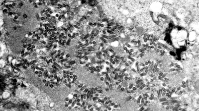 This undated electron microscope image provided by the Centers for Disease Control and Prevention shows rabies virions, dark and bullet-shaped, within an infected tissue sample.