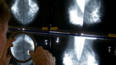 Ap25111643520093