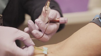 CAR T-cell therapy involves collecting a patient’s immune cells and engineering them to recognize and destroy cancer cells before returning them to the body through an IV infusion. This process takes place at the Roswell Park GMP Engineering & Cell Manufacturing Facility (GEM), one of the largest of its kind in the United States.