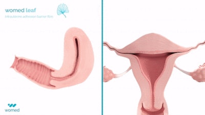 Womed Leaf Principle
