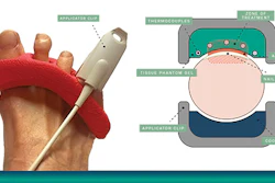 BiaCure's Onychomycosis treatment.