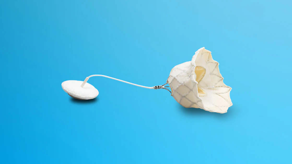 Loop Device Replacement FDA Approves Device to Replace the Mitral Valve Without Open-Heart ...