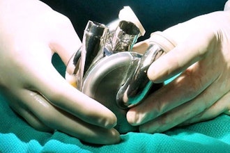 Bi Vacor Total Artificial Heart Surgery 65d4f98d7c8bb