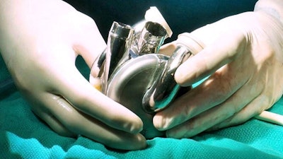 Bi Vacor Total Artificial Heart Surgery 65d4f98d7c8bb