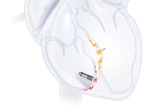 Ebr Wi Se And Micra Press Release